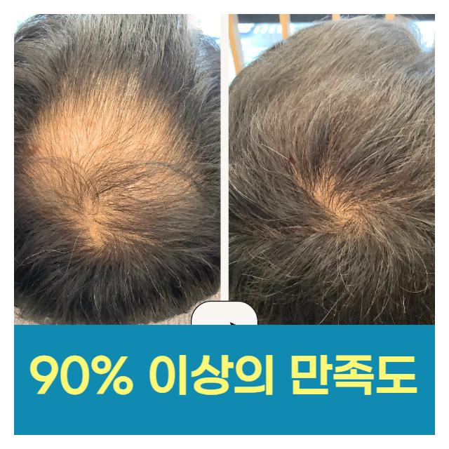 탈모 피부과 의원 90% 이상의 만족도를 자랑합니다