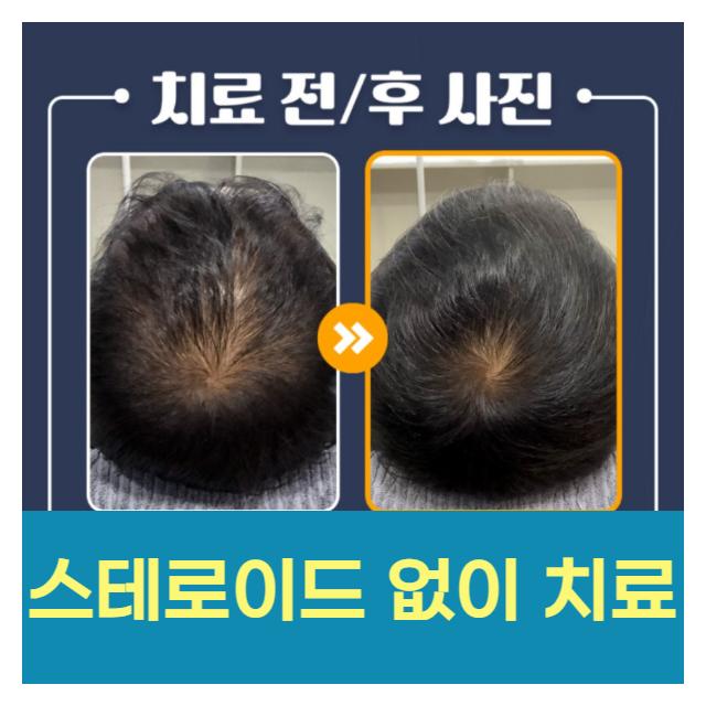 스테로이드 성분은 일체 포함하지 않은 안전한 약물만을 사용